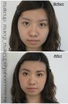before / after